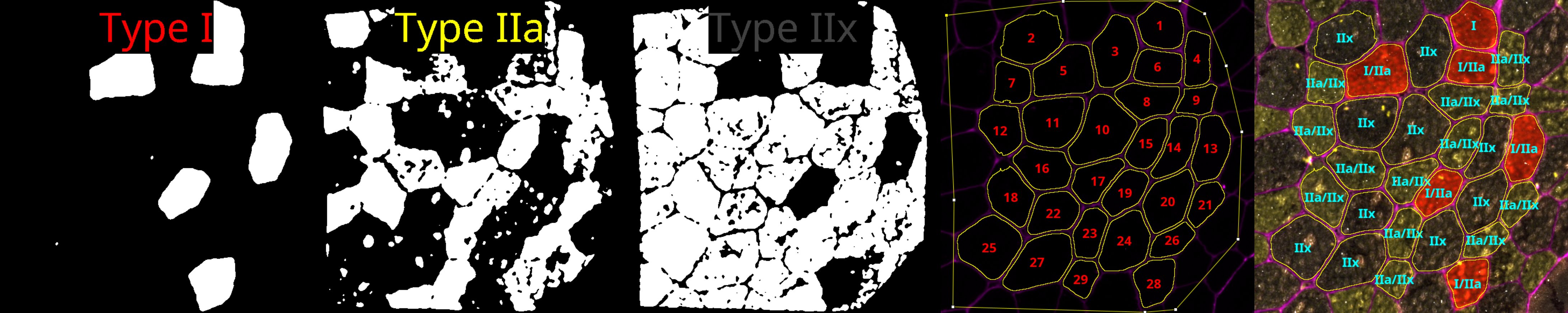 Immunostained Fluorescence Muscle Fiber-Typing